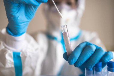 Laboratuvar laboratuarında hemşire doktor tarafından yapılan koronavirüs PCR antijen testi süreci, COVID-19 örnek toplama kiti, OP NP hasta numunesi almak için test tüpü, bir test örneği almak için hasta