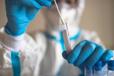 Laboratuvar laboratuarında hemşire doktor tarafından yapılan koronavirüs PCR antijen testi süreci, COVID-19 örnek toplama kiti, OP NP hasta numunesi almak için test tüpü, bir test örneği almak için hasta