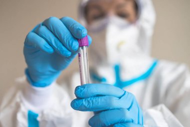Laboratuvar laboratuarında hemşire doktor tarafından yapılan koronavirüs PCR antijen testi süreci, COVID-19 örnek toplama kiti, OP NP hasta numunesi almak için test tüpü, bir test örneği almak için hasta
