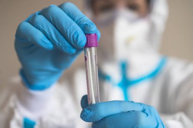 Laboratuvar laboratuarında hemşire doktor tarafından yapılan koronavirüs PCR antijen testi süreci, COVID-19 örnek toplama kiti, OP NP hasta numunesi almak için test tüpü, bir test örneği almak için hasta