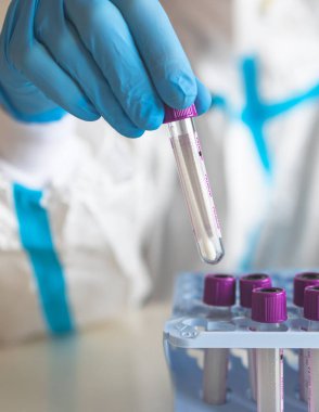 Laboratuvar laboratuarında hemşire doktor tarafından yapılan koronavirüs PCR antijen testi süreci, COVID-19 örnek toplama kiti, OP NP hasta numunesi almak için test tüpü, bir test örneği almak için hasta