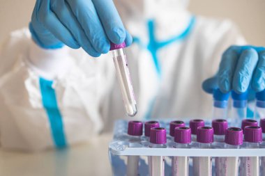 Laboratuvar laboratuarında hemşire doktor tarafından yapılan koronavirüs PCR antijen testi süreci, COVID-19 örnek toplama kiti, OP NP hasta numunesi almak için test tüpü, bir test örneği almak için hasta