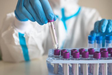 Laboratuvar laboratuarında hemşire doktor tarafından yapılan koronavirüs PCR antijen testi süreci, COVID-19 örnek toplama kiti, OP NP hasta numunesi almak için test tüpü, bir test örneği almak için hasta