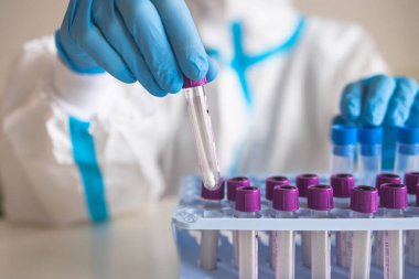 Laboratuvar laboratuarında hemşire doktor tarafından yapılan koronavirüs PCR antijen testi süreci, COVID-19 örnek toplama kiti, OP NP hasta numunesi almak için test tüpü, bir test örneği almak için hasta