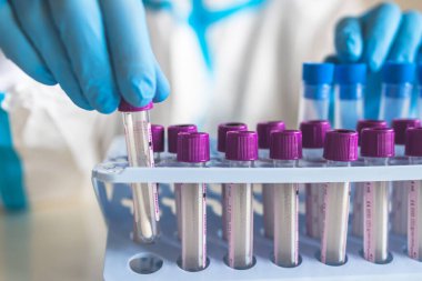 Laboratuvar laboratuarında hemşire doktor tarafından yapılan koronavirüs PCR antijen testi süreci, COVID-19 örnek toplama kiti, OP NP hasta numunesi almak için test tüpü, bir test örneği almak için hasta