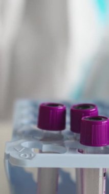 Laboratuvar laboratuvarında hemşire doktor tarafından yapılan koronavirüs PCR antijen testi süreci, COVID-19 örnek toplama kiti, OP NP hasta numunesi almak için test tüpü, hasta testi, 4K 