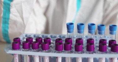 Laboratuvar laboratuvarında hemşire doktor tarafından yapılan koronavirüs PCR antijen testi süreci, COVID-19 örnek toplama kiti, OP NP hasta numunesi almak için test tüpü, hasta testi, 4K 