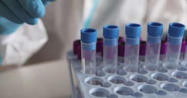 Laboratuvarda hemşire doktor tarafından yapılan koronavirüs PCR antijen testi süreci, COVID-19 pamuk toplama kiti, OP NP hasta numunesi almak için test tüpü, hastanın test edilmesi, dikey görüş.