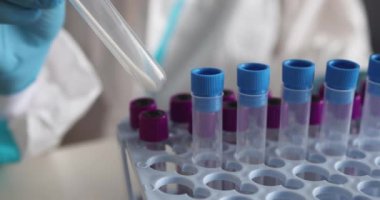 Laboratuvarda hemşire doktor tarafından yapılan koronavirüs PCR antijen testi süreci, COVID-19 pamuk toplama kiti, OP NP hasta numunesi almak için test tüpü, hastanın test edilmesi, dikey görüş.