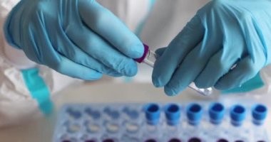 Laboratuvarda hemşire doktor tarafından yapılan koronavirüs PCR antijen testi süreci, COVID-19 pamuk toplama kiti, OP NP hasta numunesi almak için test tüpü, hastanın test edilmesi, dikey görüş.