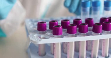 Laboratuvarda hemşire doktor tarafından yapılan koronavirüs PCR antijen testi süreci, COVID-19 pamuk toplama kiti, OP NP hasta numunesi almak için test tüpü, hastanın test edilmesi, dikey görüş.