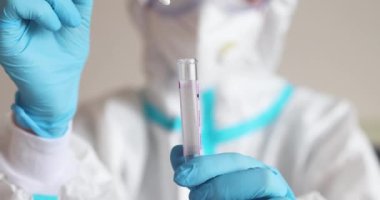 Laboratuvarda hemşire doktor tarafından yapılan koronavirüs PCR antijen testi süreci, COVID-19 pamuk toplama kiti, OP NP hasta numunesi almak için test tüpü, hastanın test edilmesi, dikey görüş.