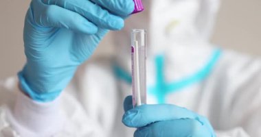 Laboratuvarda hemşire doktor tarafından yapılan koronavirüs PCR antijen testi süreci, COVID-19 pamuk toplama kiti, OP NP hasta numunesi almak için test tüpü, hastanın test edilmesi, dikey görüş.