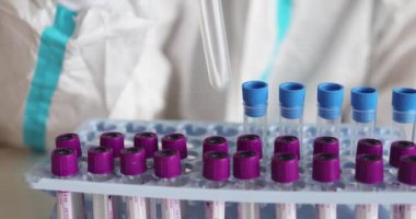 Laboratuvarda hemşire doktor tarafından yapılan koronavirüs PCR antijen testi süreci, COVID-19 pamuk toplama kiti, OP NP hasta numunesi almak için test tüpü, hastanın test edilmesi, dikey görüş.