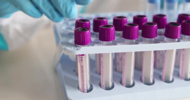 Laboratuvarda Hemşire Doktor Tarafından Yapılan Koronavirüs Pcr Antijen Testi Süreci — Stok video