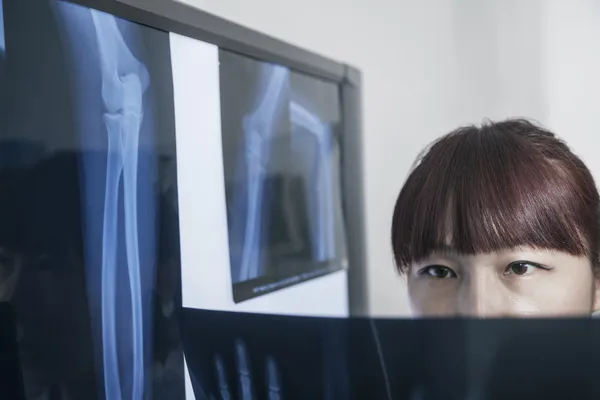 Doctor looking at x-ray of human bones — Stock Photo, Image