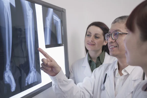 Ärzte untersuchen Röntgenbilder menschlicher Knochen — Stockfoto