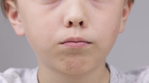 Pojke 9 år gör orala motorövningar. — Stockvideo