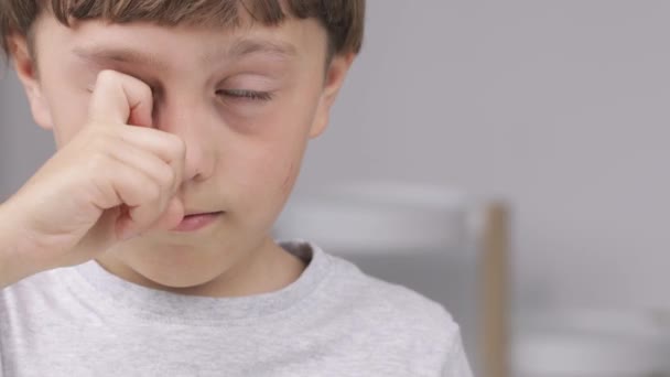 El chico le pica la cara.. — Vídeos de Stock