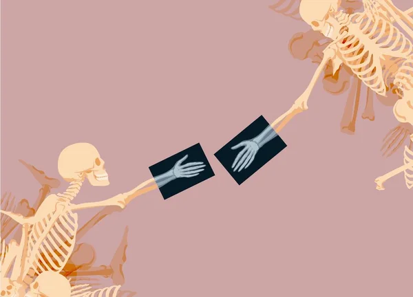 Los esqueletos se extienden las manos entre sí. Composición escultórica creativa con huesos y rayos X — Vector de stock