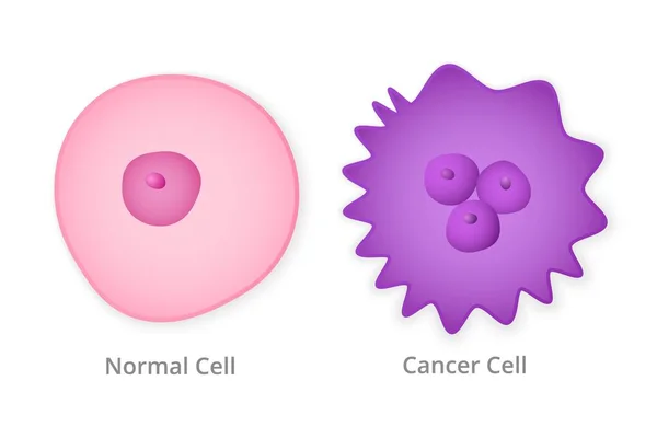 Células normales y cáncer — Vector de stock