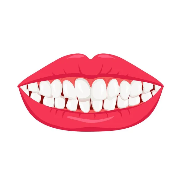 Smile Crooked Teeth White Misaligned Teeth Orthodontic Bruxism Need Dental — Stock Vector
