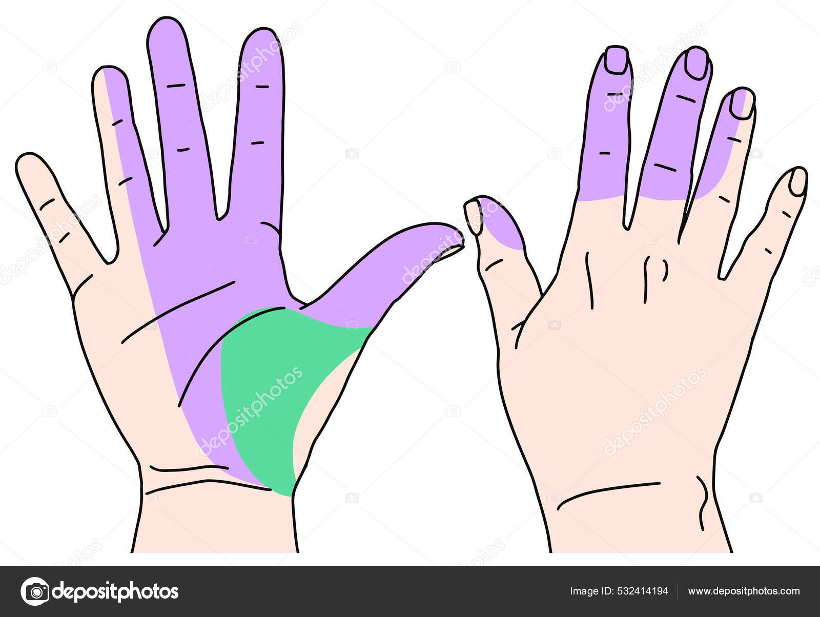 Carpal Tunnel Syndrome median nerve Stock Vector Image by ©  #532414194