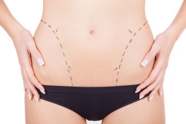 kalça iyileştirilmesi için hazır.