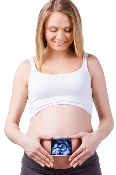 Pregnant woman holding x-ray image — Stock Photo, Image