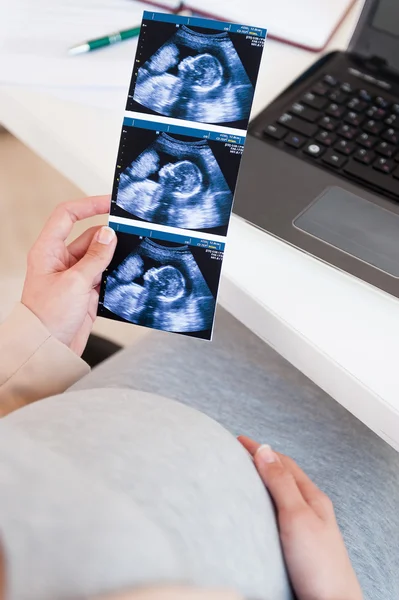 Mulher com imagem de ultrassonografia . — Fotografia de Stock