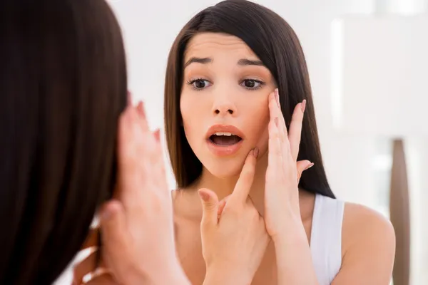 Woman worried about acne. — Stock Photo, Image