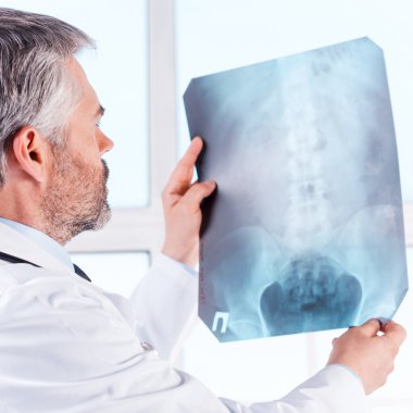 Doktor X-ray görüntüsünü inceliyor