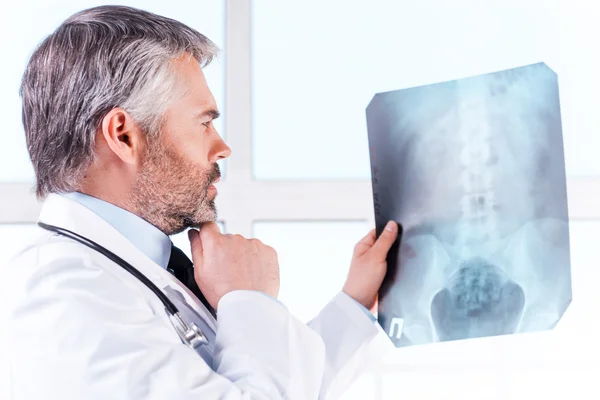 Lekarz badający rentgen. — Zdjęcie stockowe