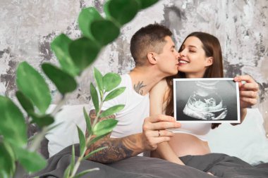 Genç ve sevecen bir çift, hamile bir kız, sabahları pijamalarıyla yatağa uzanıyor ve ultrason taramasında bir bebeğin resmini inceliyor..