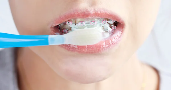 El uso correcto de un cepillo dental para una higiene bucal perfecta —  Fotos de Stock