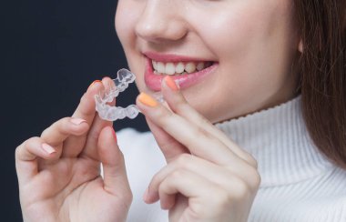 Kadın giyiyor ortodontik silikon eğitmeni. Görünmez diş telleri aligner