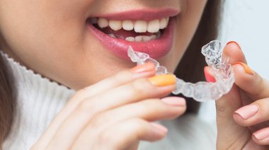 Kadın giyiyor ortodontik silikon eğitmeni. Görünmez diş telleri aligner