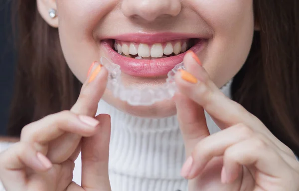 Woman Wearing Orthodontic Silicone Trainer Invisible Braces Aligner — Stock Photo, Image