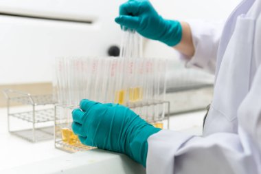 Kimyager, laboratuvarda antiretroviral ilaçlar, COVID-19 'a karşı potansiyel ilaç ve aşı üreticileri bulmak için kimyasalları karıştırdı.