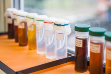 Laboratuar kapkacakları