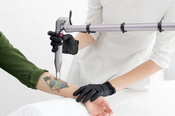 Esteticista utilizando un dispositivo láser para eliminar un tatuaje no deseado del brazo femenino. Concepto de borrar tatuajes como un procedimiento costoso en una clínica de cosmetología — Foto de Stock