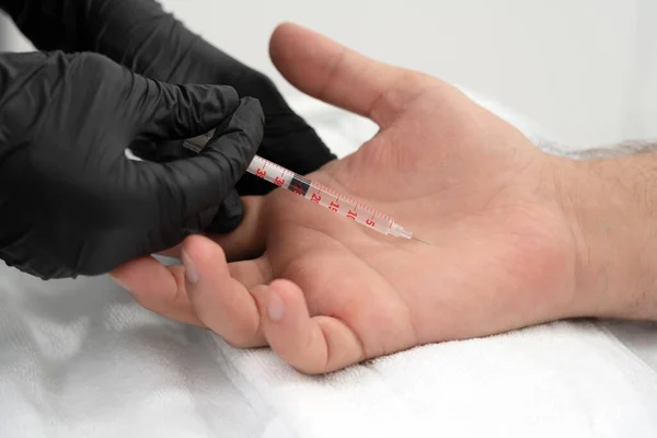 Doctor makes a shot of botulinum toxin in the hand of a male palm against excessive sweating, treatment of hyperhidrosis Stock Picture