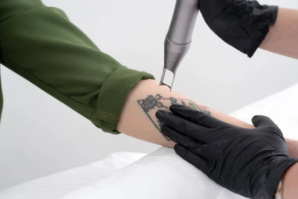 Beautician using laser device to remove an unwanted tattoo from female arm. Concept of erasing tattoos as an expensive procedure in a cosmetology clinic — Stock Photo, Image