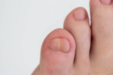 Beyaz arka planda iki küçük ayak parmağı olan kadın ayakları.