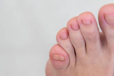 Büyük, çift küçük ayak parmaklı kadın ayakları.