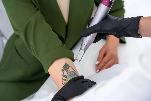 Kosmetolog med laser för att ta bort en oönskad tatuering från kvinnlig arm. Begreppet radering av tatueringar som ett dyrt förfarande på en kosmetologisk klinik Stockbild