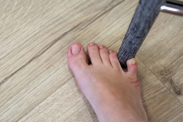 Mulher bateu móveis com o dedo mindinho. Incidente em casa. Lesão do dedo mindinho do pé — Fotografia de Stock