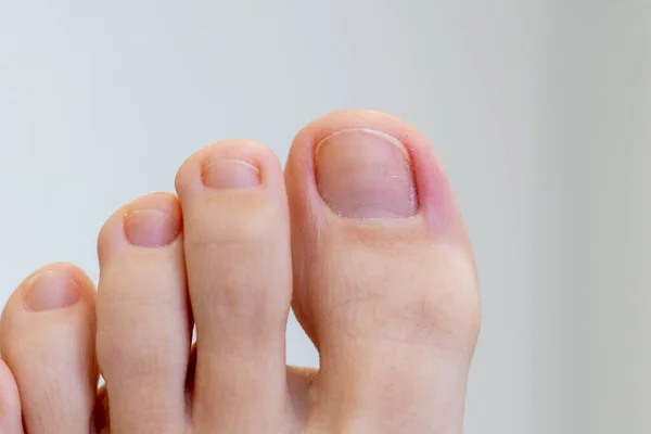 Fechar os pés e os dedos dos pés femininos. Conceito de pés saudáveis — Fotografia de Stock