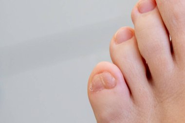 Büyük çift ayak parmaklı kadın ayaklarına yakın çekim.