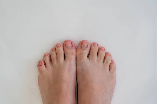 Zbliżenie żeńskich stóp i palców na białym tle. Koncepcja zdrowych stóp — Zdjęcie stockowe